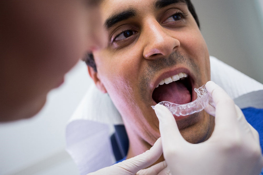 Invisalign: Clear aligners